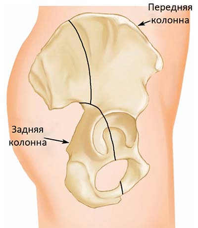 Метод 2: Хирургические методы лечения